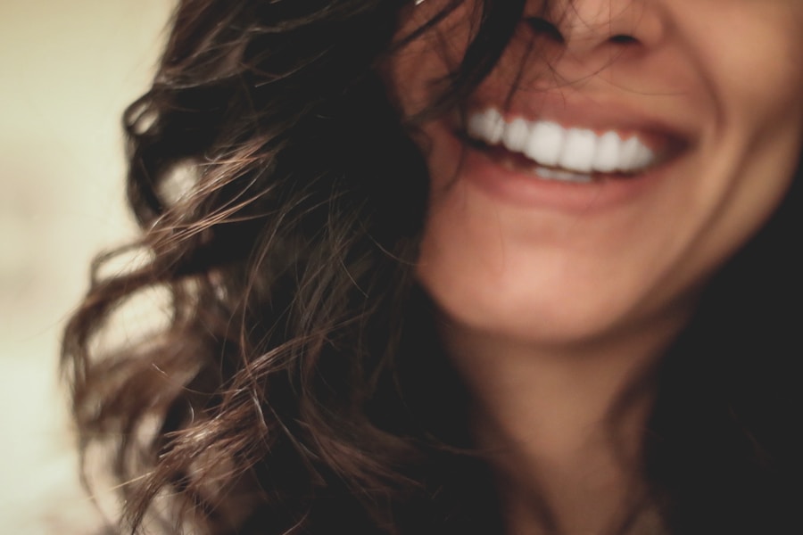 Resultado de clareamento dental, sorriso branco e natural